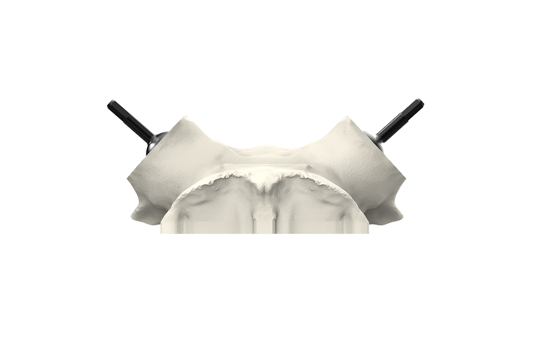 Universal Whitetail Skull Plate - Powered by Rack Hub®