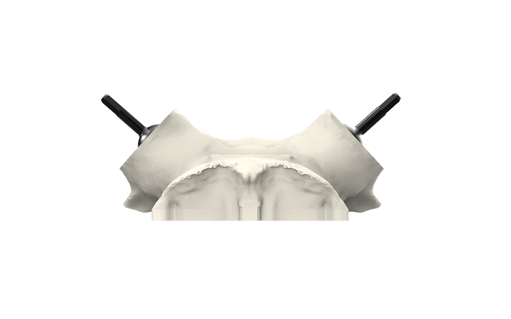 Universal Whitetail Skull Plate - Powered by Rack Hub®